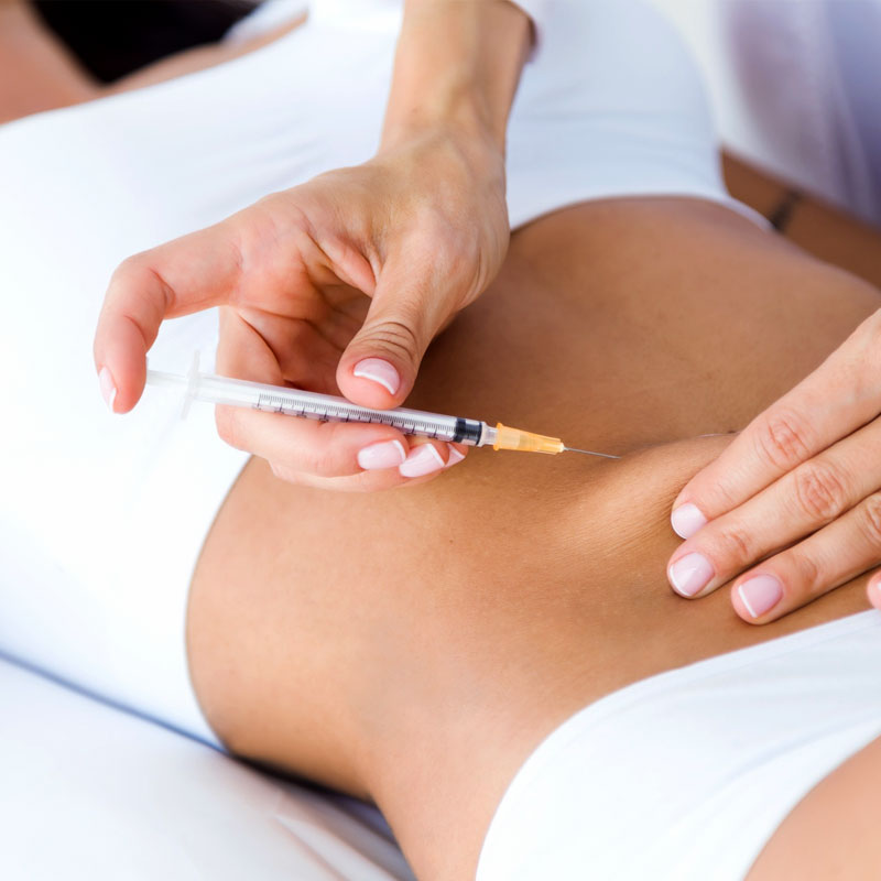 Carboxiterapia